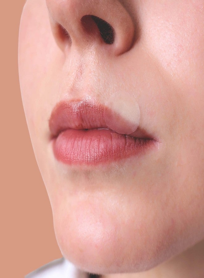 SMARTMED Smart Cold Sore Treatment Patch with Lemon Balm Large 15mm Soothe Itching and Burning - Skin Safe Adhesive - Image 2